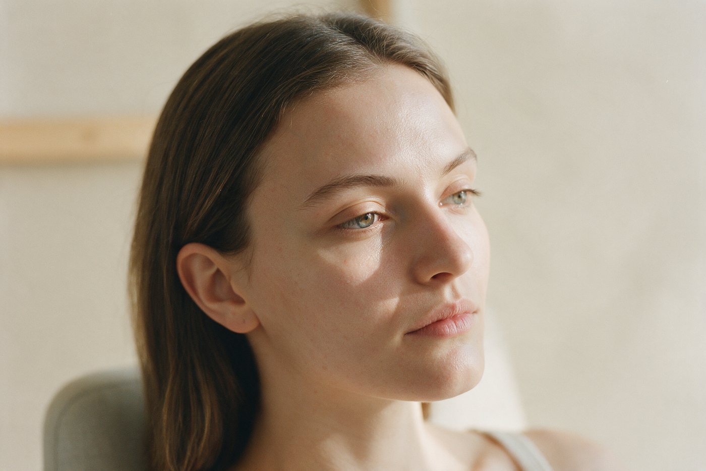 Cicatrizes de acne: por que o tratamento depende do tipo de cicatriz e da qualidade da pele?