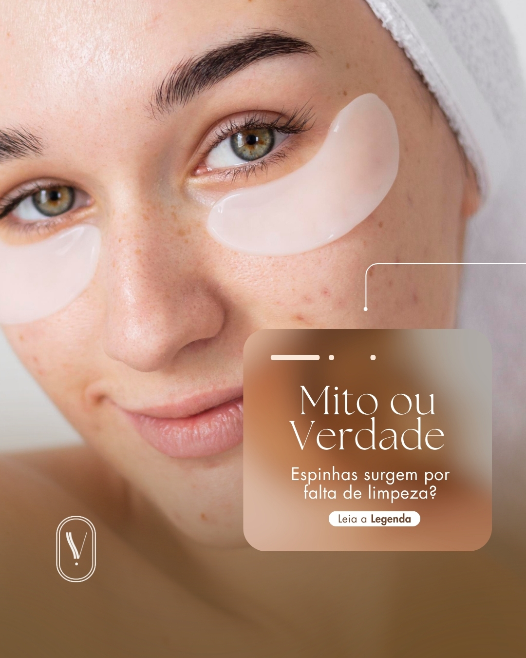 Espinhas surgem por falta de limpeza? Mito ou verdade