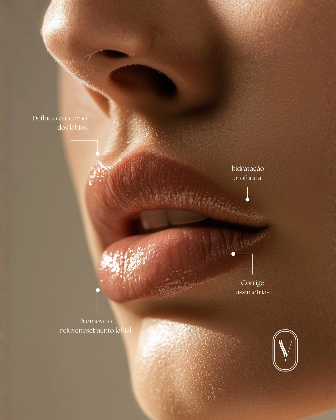 Preenchimento labial: naturalidade e harmonia facial