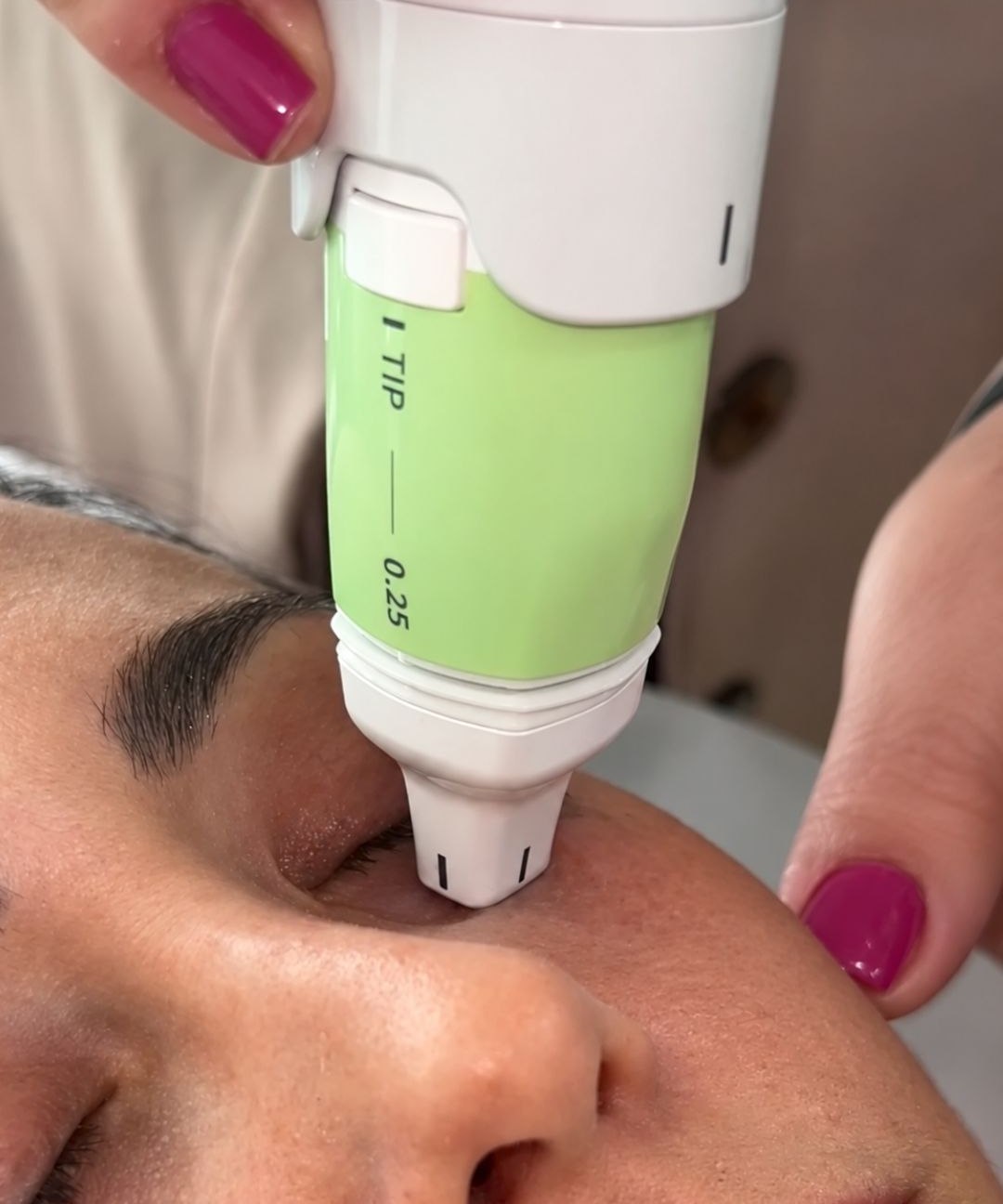 Firmeza e rejuvenescimento