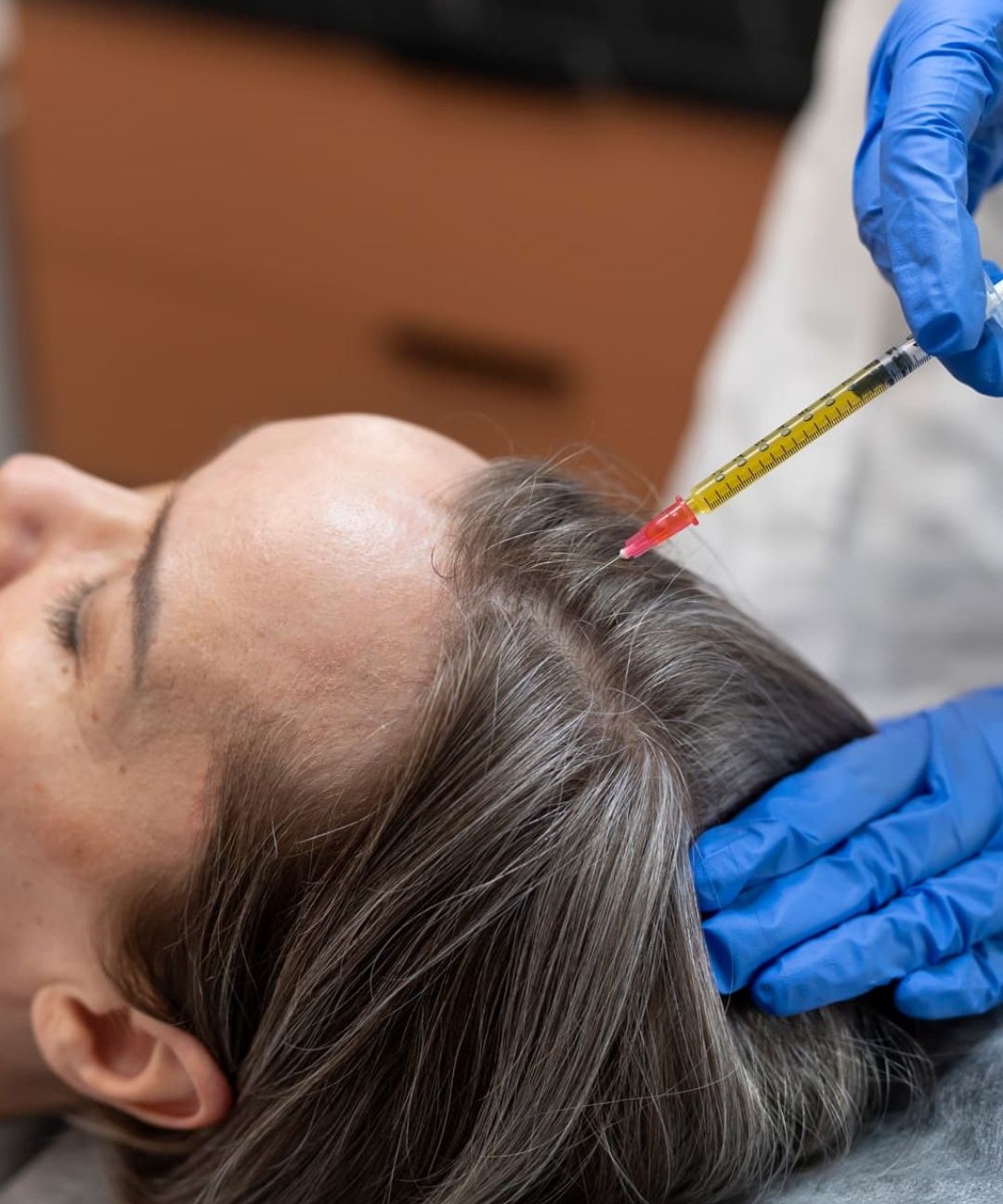 Mesoterapia Capilar em Mogi Mirim
